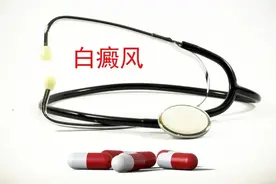 儿童白癜风常见病因有哪些？图片