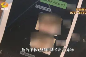 女生称被男友传染疾病后遭抛弃：承诺好好生活他却离开了图片