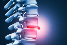 膨出的椎间盘能回去吗图片