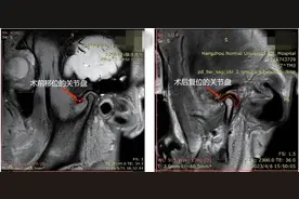 整张脸变歪！18岁漂亮姑娘突然嘴都张不开，问题出在这图片