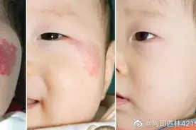 从三个真实医学故事说起图片