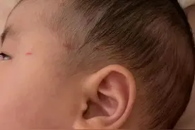 无人机失控，突然撞过来！杭城4个月大婴儿被割伤图片