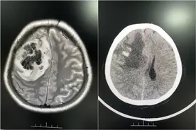 25岁女主播昏迷不醒！医生一看，又跟这种行为有关！图片