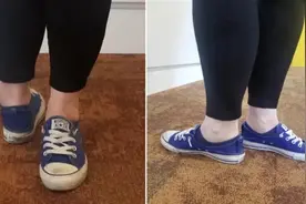 女子双脚能向后旋转近180度，创造纪录！图片