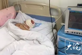 好消息！小南南手术结束 眼睛和嘴巴能闭上了图片