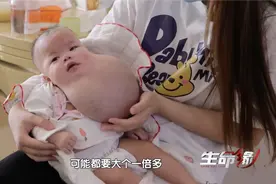 00后孕妈产检发现孩子发育异常，舍弃还是保留？女婴曾面临三次生死选择图片