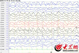 肝病能引起脑病？菏泽市三院专家：动态脑电图帮助确诊肝性脑病图片