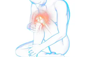 膝盖“咔咔”响，到底是为啥？图片