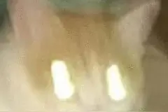 使用不当，“瞬间致盲”！图片