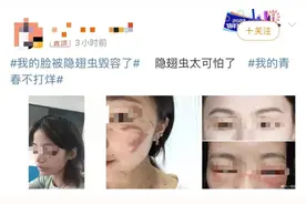 这种虫飞到身上千万别拍打！毒液堪比硫酸，有人差点毁容……图片