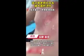 孩子帮老师打开水被大面积烫伤，孩子家长：老师拒绝协商……图片