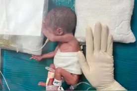 【动态】28周早产的拇指姑娘回娘家图片