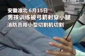 男孩训练时被弓箭射穿小腿，消防员小心翼翼用切割机切割图片