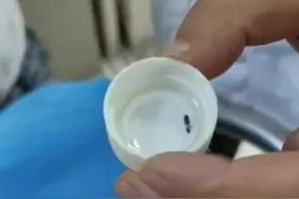 30秒 ｜ 虫子钻进耳朵致剧烈疼痛 女子深夜尖叫惊动警察图片