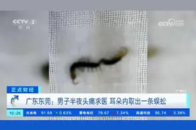 男子耳朵里取出4厘米长蜈蚣视频封面