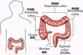 肠镜检查发现息肉怎么办？如何预防？医生解答图片