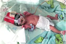 揪心！双胞胎男婴刚出生就进ICU图片