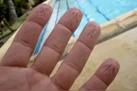 泡水久，手指为何变皱图片