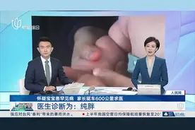 怀疑宝宝患罕见病 家长驱车600公里求医 医生诊断为：纯胖图片