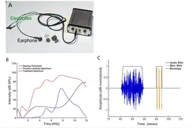 科学家开发出一种治疗耳鸣的新型疗法 超过60%测试者症状明显减轻图片