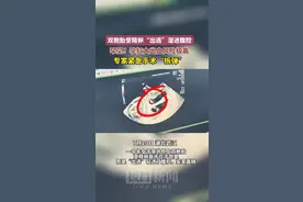 罕见！受精卵出逃钻进女子腹腔，专家紧急手术“拆弹”图片