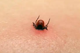 美国疾控警告：一朝被蜱虫咬，终身再也不能吃肉图片