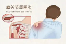 总是肩膀痛？这几个动作助你缓解！图片