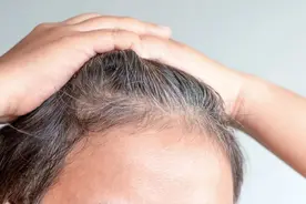 头发“褪色”了？竟是它的锅→图片