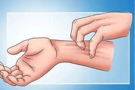 天气热热热！瘢痕痒痒痒！赶紧用这些方法缓解！图片