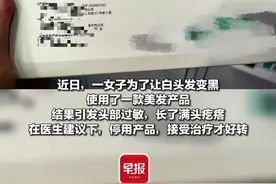 花数千元买头发“白转黑”产品，不料头皮却长满疙瘩！图片
