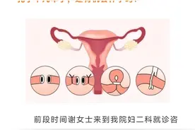 结扎十几年后想生娃？微创输卵管复通术后成功怀孕！图片