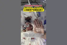 从560克到3200克！多学科通力守护下，这对超早产双胞胎姐妹出院了！图片