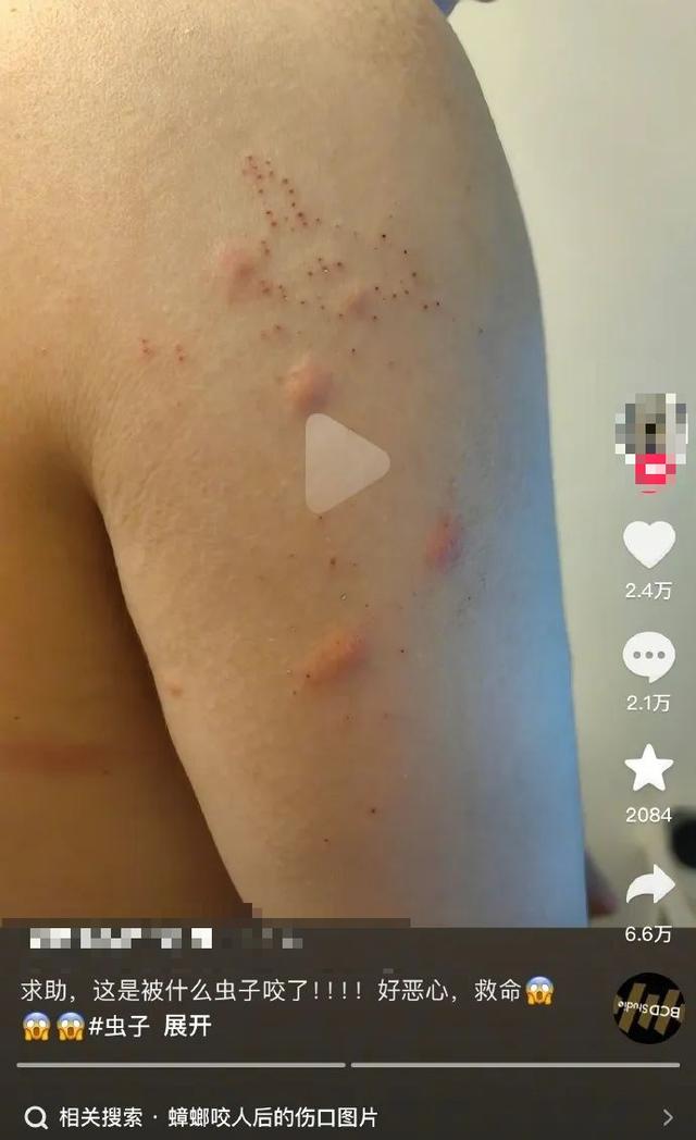 头皮发麻！蟑螂会咬人？专家说……