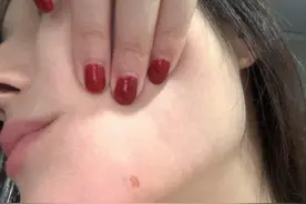 “女子在INS新乐园被醉汉烟头烫伤”新进展：受伤女子获赔付，双方达成和解图片