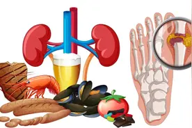 15岁男孩尿酸“爆表”引关注 | 高尿酸血症低龄化，如何破局图片