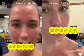 满是血痕！中国女子水球队长发图回怼澳球员：对抗项目，谁也别说谁图片