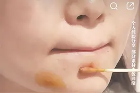 消毒剂变“美容圣品” 碘伏真能美白？图片