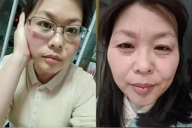 妇科专家看“断崖式衰老”：卵巢早衰是病，但自然衰老意味着女性的成熟和宽阔图片
