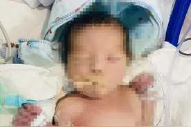 羊水粪染致男婴一出生即脑死亡，家属认为医院处置不当；业内人士：出现异常应及时手术终止妊娠图片