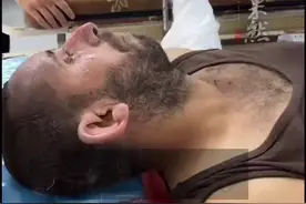 巴勒斯坦父子在医院相遇，受伤父亲挣扎起身亲吻儿子，反被安慰：不要怕，爸爸图片