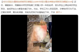 女孩被老师揪耳朵致2厘米撕裂缝针？  官方：涉事教师已停课协助调查图片