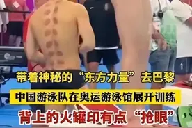 热闻|奥运赛场上再现神秘“东方力量”火罐印，为何游泳运动员偏爱拔火罐？图片
