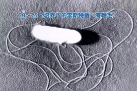 一杯下肚，孕妈高烧、宝宝早产休克！这种细菌冰箱里常见图片