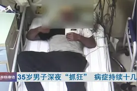 男子深夜突然“抓狂”！手脚不受控制，最终确诊……图片