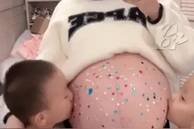贵州双胞胎宝妈又怀上三胞胎，医生建议减胎但她很矛盾，“全家收入就是老公的七八千月薪”图片
