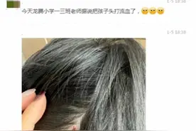 郑州一小学生疑被老师打破头？校方：涉事教师调离教学岗位图片