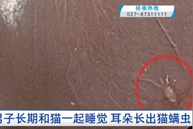 吓人！男子长期和猫一起睡觉，耳朵长出猫螨虫图片