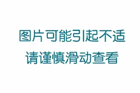 眼周长黄色斑块别忽视，可能是这个疾病信号图片