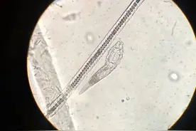 春夏交替，螨虫的危害别忽视......图片