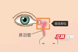 永医科普丨小宝宝眼泪汪汪，是上火了吗？图片